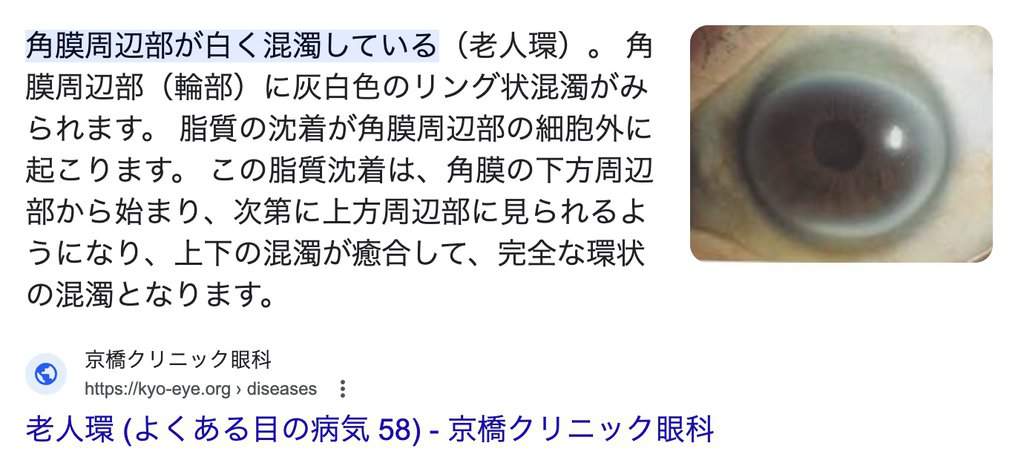 和泉伸二　青い目　老人環